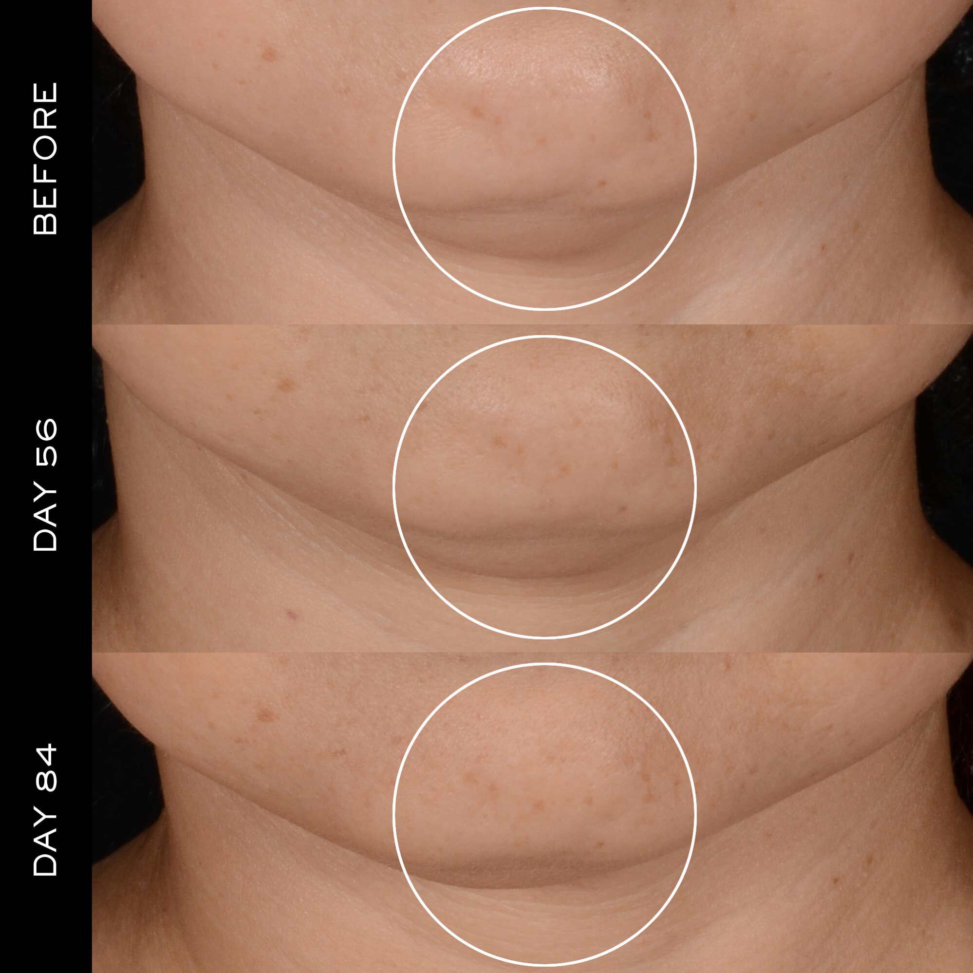 H.P.N. 300-PEPTIDE CREAM - REFILLABLE